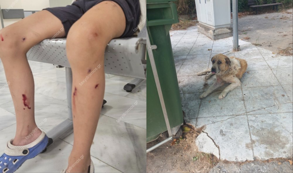 Υποβλήθηκε σε χειρουργική επέμβαση ο 7χρονος που κατασπαράχθηκε από αδέσποτα