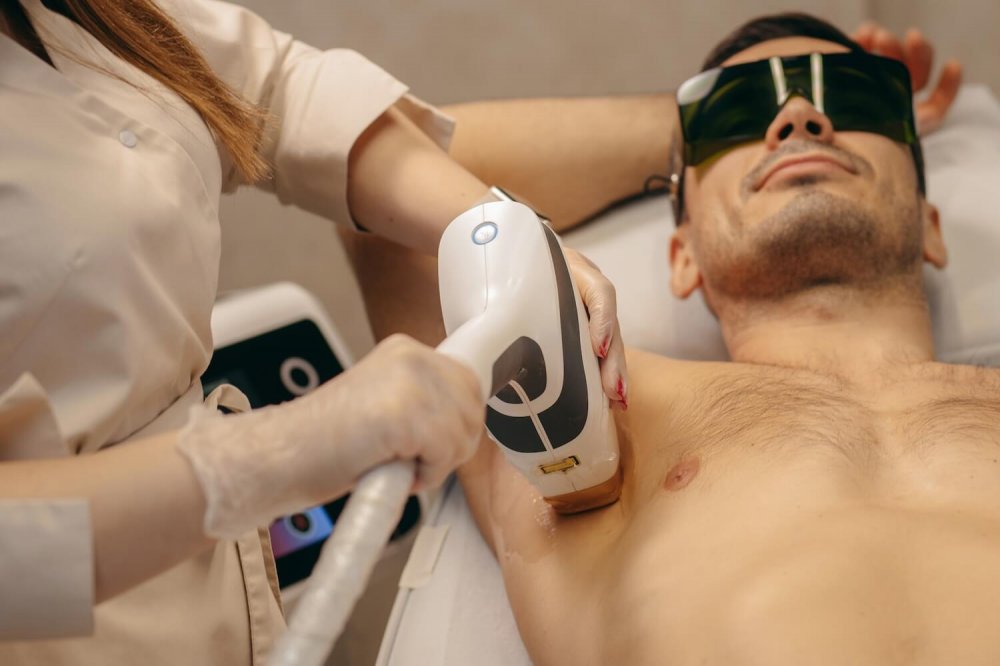 Laser για Άνδρες: 5 Λόγοι που Είναι Προτιμότερο από το Ξύρισμα