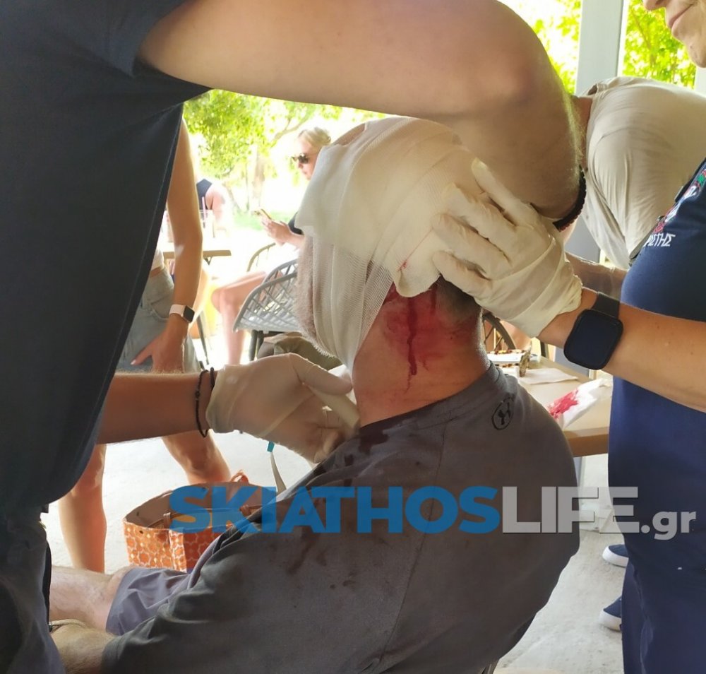 Σκιάθος: Νέος τραυματισμός από jet blast έξω από το αεροδρόμιο – Στο Κέντρο Υγείας 55χρονος (εικόνες)